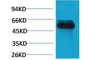 Western Blotting (WB) image for anti-Tripartite Motif Containing 72 (TRIM72) antibody (ABIN3179018) (TRIM72 antibody)