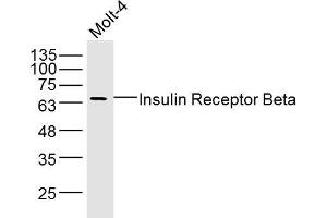 Molt-4 lysates probed with Insulin Receptor Beta Polyclonal Antibody, Unconjugated  at 1:300 dilution and 4˚C overnight incubation. (ISR-beta antibody  (AA 1001-1100))