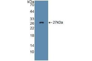 Western blot analysis of recombinant Mouse FBN1.