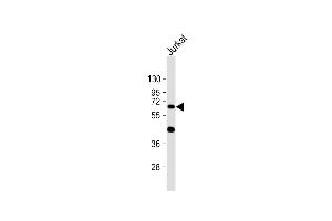 Anti- at 1:1000 dilution + Jurkat whole cell lysate Lysates/proteins at 20 μg per lane.