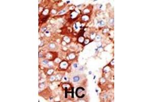 Immunohistochemistry (IHC) image for anti-Acyl-CoA Synthetase Long-Chain Family Member 4 (ACSL4) antibody (ABIN3001550) (ACSL4 antibody)