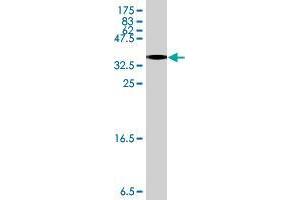 Western Blot detection against Immunogen (34. (GPAM antibody  (AA 749-828))