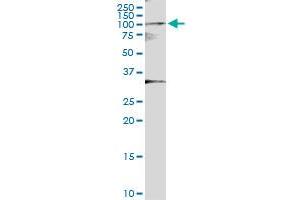 Immunoprecipitation of MYST2 transfected lysate using anti-MYST2 MaxPab rabbit polyclonal antibody and Protein A Magnetic Bead , and immunoblotted with MYST2 MaxPab mouse polyclonal antibody (B01) . (MYST2 antibody  (AA 1-611))