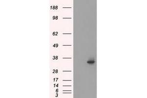 HEK293T cells were transfected with the pCMV6-ENTRY control (Left lane) or pCMV6-ENTRY SRR (Right lane) cDNA for 48 hrs and lysed. (SRR antibody)