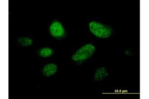 Immunofluorescence of purified MaxPab antibody to C14orf106 on HeLa cell. (MIS18 Binding Protein 1 (MIS18BP1) (AA 1-314) antibody)