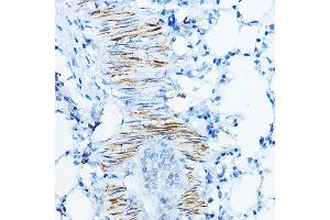 Immunohistochemistry (IHC) image for anti-Desmin (DES) (AA 121-470) antibody (ABIN3021115)