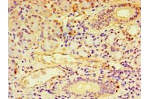Immunohistochemistry of paraffin-embedded human pancreatic tissue using ABIN7145570 at dilution of 1:100 (NDST1 antibody  (AA 40-556))