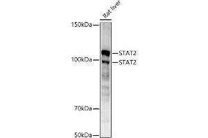 Western blot analysis of extracts of Rat liver, using ST antibody (ABIN1678782, ABIN3017845, ABIN3017846 and ABIN7101526) at 1:1000 dilution. (STAT2 antibody)