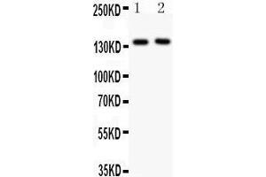 Anti- CD62P Picoband antibody, Western blotting All lanes: Anti CD62P  at 0. (P-Selectin antibody  (AA 42-271))