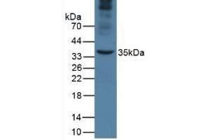 Detection of APOA5 in Mouse Liver Tissue using Monoclonal Antibody to Apolipoprotein A5 (APOA5) (APOA5 antibody  (AA 21-210))