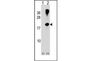 Western blot analysis of RHOG (arrow) using RhoG Antibody (C-term) Cat. (RHOG antibody  (C-Term))