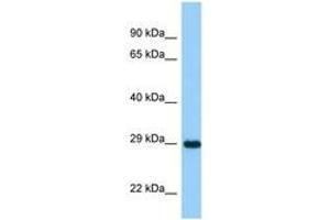 Image no. 1 for anti-Ankyrin Repeat and SOCS Box-Containing 11 (ASB11) (AA 21-70) antibody (ABIN6748270) (ASB11 antibody  (AA 21-70))
