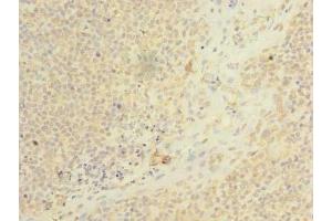 Immunohistochemistry of paraffin-embedded human tonsil tissue using ABIN7158460 at dilution of 1:100 (ARMC9 antibody  (AA 401-665))