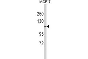 Western Blotting (WB) image for anti-Calponin Homology Domain Containing 2 (CHDC2) antibody (ABIN3003994)