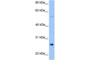 Western Blotting (WB) image for anti-Methyltransferase Like 7B (METTL7B) antibody (ABIN2463256) (METTL7B antibody)