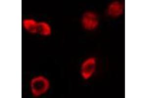 ABIN6274163 staining HeLa cells by IF/ICC. (HKR1 antibody)