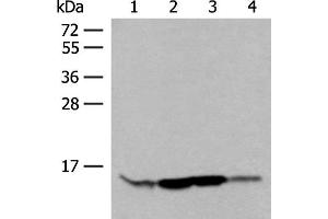 Western blot analysis of HL60 Hela 231 cell Human breast cancer tissue lysates using RPP14 Polyclonal Antibody at dilution of 1:400