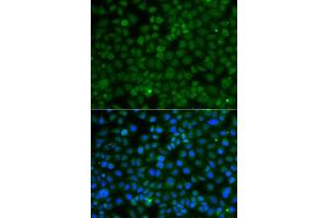 Immunofluorescence analysis of A549 cell using WDR45 antibody.