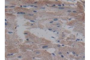 Immunohistochemistry (IHC) image for anti-Cerebral Dopamine Neurotrophic Factor (CDNF) (AA 20-183) antibody (ABIN7436288)