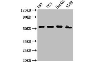 Western Blot Positive WB detected in: U87 whole cell lysate, PC-3 whole cell lysate, HepG2 whole cell lysate, A549 whole cell lysate All lanes: PPP2R2D antibody at 3. (PPP2R2D antibody  (Regulatory Subunit B))