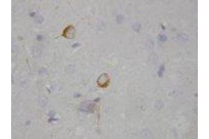 Image no. 1 for anti-Nitric Oxide Synthase 1, Neuronal (NOS1) (AA 1418-1434) antibody (ABIN1493385) (NOS1 antibody  (AA 1418-1434))