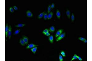 Immunofluorescent analysis of HepG2 cells using ABIN7161010 at dilution of 1:100 and Alexa Fluor 488-congugated AffiniPure Goat Anti-Rabbit IgG(H+L) (NADPH Oxidase 4 antibody  (AA 210-424))