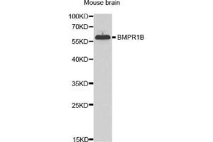 Western Blotting (WB) image for anti-Bone Morphogenetic Protein Receptor, Type IB (BMPR1B) (AA 1-126) antibody (ABIN3022720) (BMPR1B antibody  (AA 1-126))