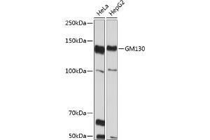 Golgin A2 (GOLGA2) 抗体