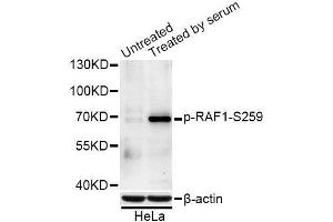 Western blot analysis of extracts of NIH/3T3 and HeLa cells, using Phospho-RAF1-S259 antibody. (RAF1 antibody  (pSer259))