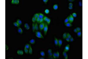 Immunofluorescence staining of HepG2 cells with ABIN7143686 at 1:100, counter-stained with DAPI. (AKR1C1 antibody  (AA 219-323))