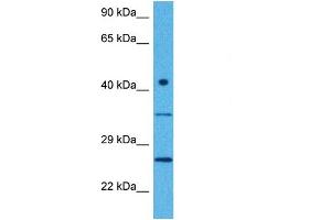 Host:  Rabbit  Target Name:  CTDNEP1  Sample Tissue:  Human MCF7 Whole Cell  Antibody Dilution:  1ug/ml (CTDNEP1A antibody  (Middle Region))
