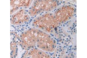 Used in DAB staining on fromalin fixed paraffin- embedded Kidney tissue (ADCY8 antibody  (AA 234-371))