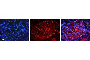 Rabbit Anti-PTCH1 Antibody   Formalin Fixed Paraffin Embedded Tissue: Human Testis Tissue Observed Staining: Plasma membrane Primary Antibody Concentration: 1:600 Other Working Concentrations: N/A Secondary Antibody: Donkey anti-Rabbit-Cy3 Secondary Antibody Concentration: 1:200 Magnification: 20X Exposure Time: 0. (Patched 1 antibody  (C-Term))