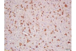 Formalin-fixed and paraffin embedded rat brain labeled with Rabbit Anti-HER4/ErbB4 Polyclonal Antibody, Unconjugated  at 1:200 followed by conjugation to the secondary antibody and DAB staining