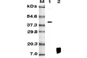 Western blot analysis using anti-RELM-β (human), mAb (HRB 149)  at 1:5'000 dilution. (RETNLB antibody)