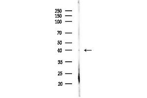 anti-alpha 1, 4-Galactosyltransferase (A4GALT) (C-Term) antibody