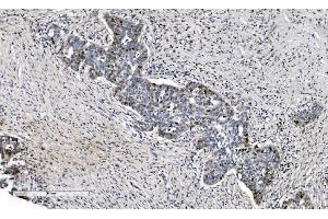 IHC analysis of MCM6 using anti-MCM6 antibody (ABIN7600036).