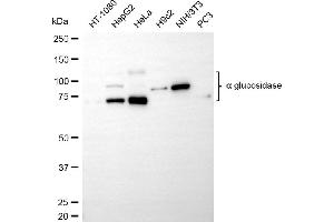 Western blotting analysis using alpha glucosidase antibody (ABIN7797585).