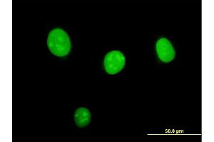 Immunofluorescence (IF) image for anti-serine/threonine Kinase 33 (STK33) (AA 1-514) antibody (ABIN566311)