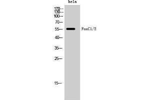Western Blotting (WB) image for anti-Forkhead Box C1 (FOXC1) (Internal Region) antibody (ABIN3175115) (FOXC1 antibody  (Internal Region))