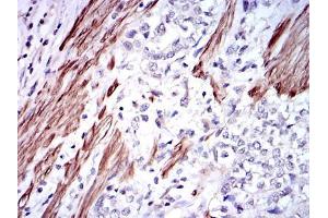 Immunohistochemistry (IHC) image for anti-Glutathione S-Transferase mu 1 (GSTM1) antibody (ABIN969180)