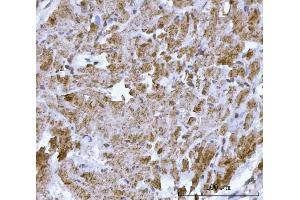 IHC analysis of DTR/HBEGF using anti-DTR/HBEGF antibody (ABIN7603042). (HBEGF antibody  (Middle Region))