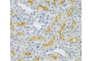 Immunohistochemistry of paraffin-embedded Rat kidney using UBE2B Polyclonal Antibody at dilution of 1:100 (40x lens). (UBE2B antibody)