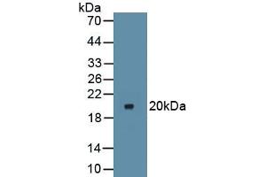 Detection of Recombinant IkBa, Mouse using Polyclonal Antibody to Inhibitory Subunit Of NF Kappa B Alpha (IkBa) (Inhibitory Subunit Of NF kappa B alpha antibody)