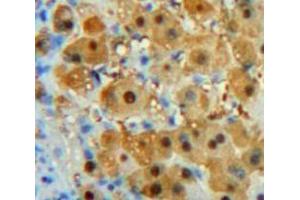 Used in DAB staining on fromalin fixed paraffin-embedded Liver tissue (PDGFC antibody  (AA 23-345))
