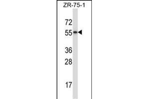 RORB Antibody (C-term) (ABIN657975 and ABIN2846921) western blot analysis in ZR-75-1 cell line lysates (35 μg/lane).