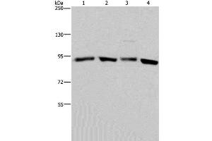 Western Blotting (WB) image for anti-Heat Shock Protein 90kDa alpha (Cytosolic), Class A Member 2 (HSP90AA2) antibody (ABIN7000014)