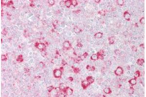 Anti-RHOD antibody IHC staining of human tonsil. (RHOD antibody  (C-Term))