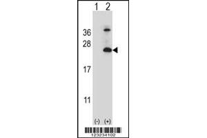 Western blot analysis of TSPAN6 using rabbit polyclonal TSPAN6 Antibody using 293 cell lysates (2 ug/lane) either nontransfected (Lane 1) or transiently transfected (Lane 2) with the TSPAN6 gene. (Tetraspanin 6 antibody  (C-Term))