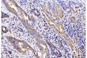 IHC analysis of Giantin/GOLGB1 using anti-Giantin/GOLGB1 antibody (ABIN7600139). (Golgin B1 (GOLGB1) (AA 153-950) antibody)